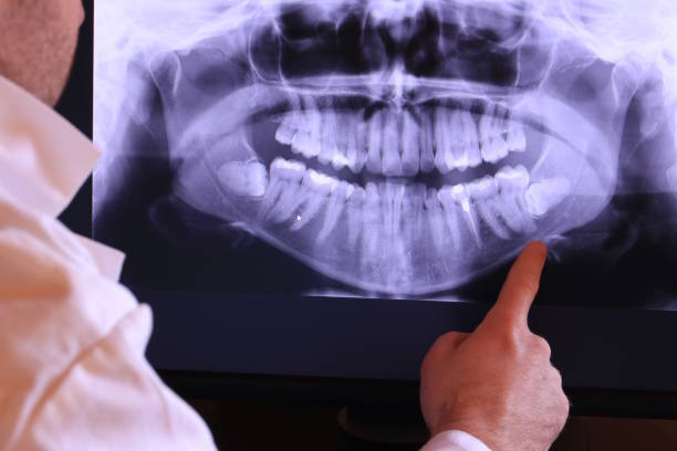 Best Emergency Broken Tooth Repair in Rossville, TN